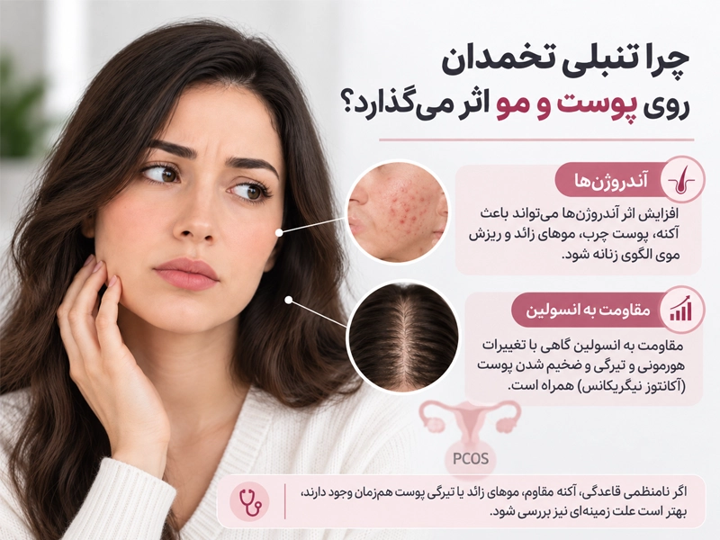 چرا تنبلی تخمدان روی پوست و مو اثر می‌گذارد؟